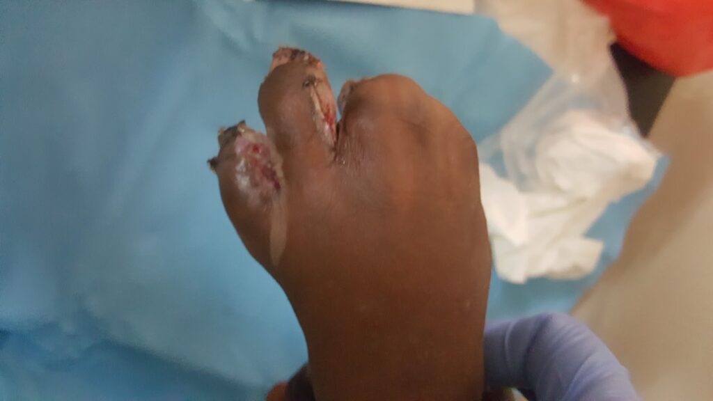 humanitarian work hand after