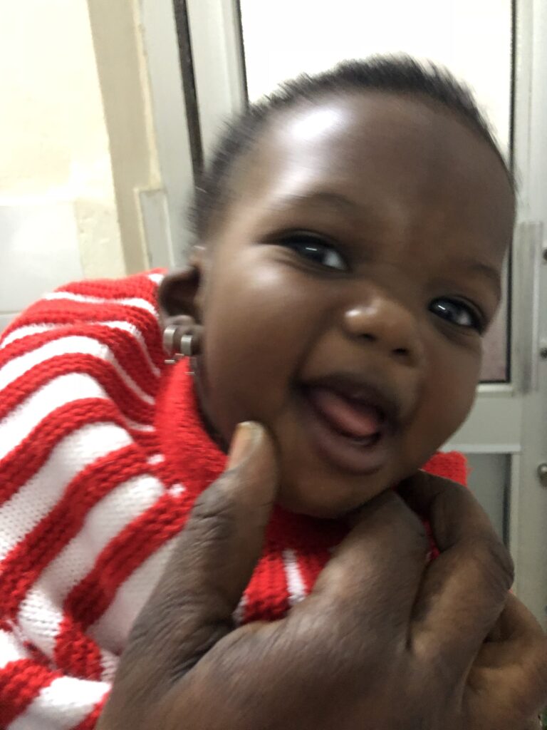 congenital ear deformity before surgery